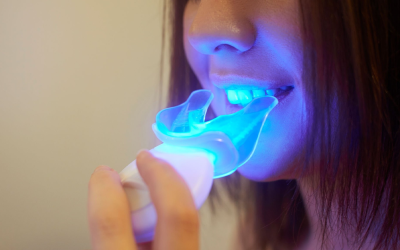 What don’t you know about home whitening kits?