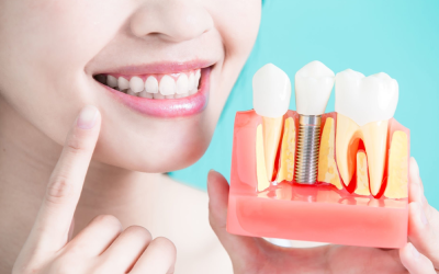 New Year, New Image with Dental Implants in Staten Island