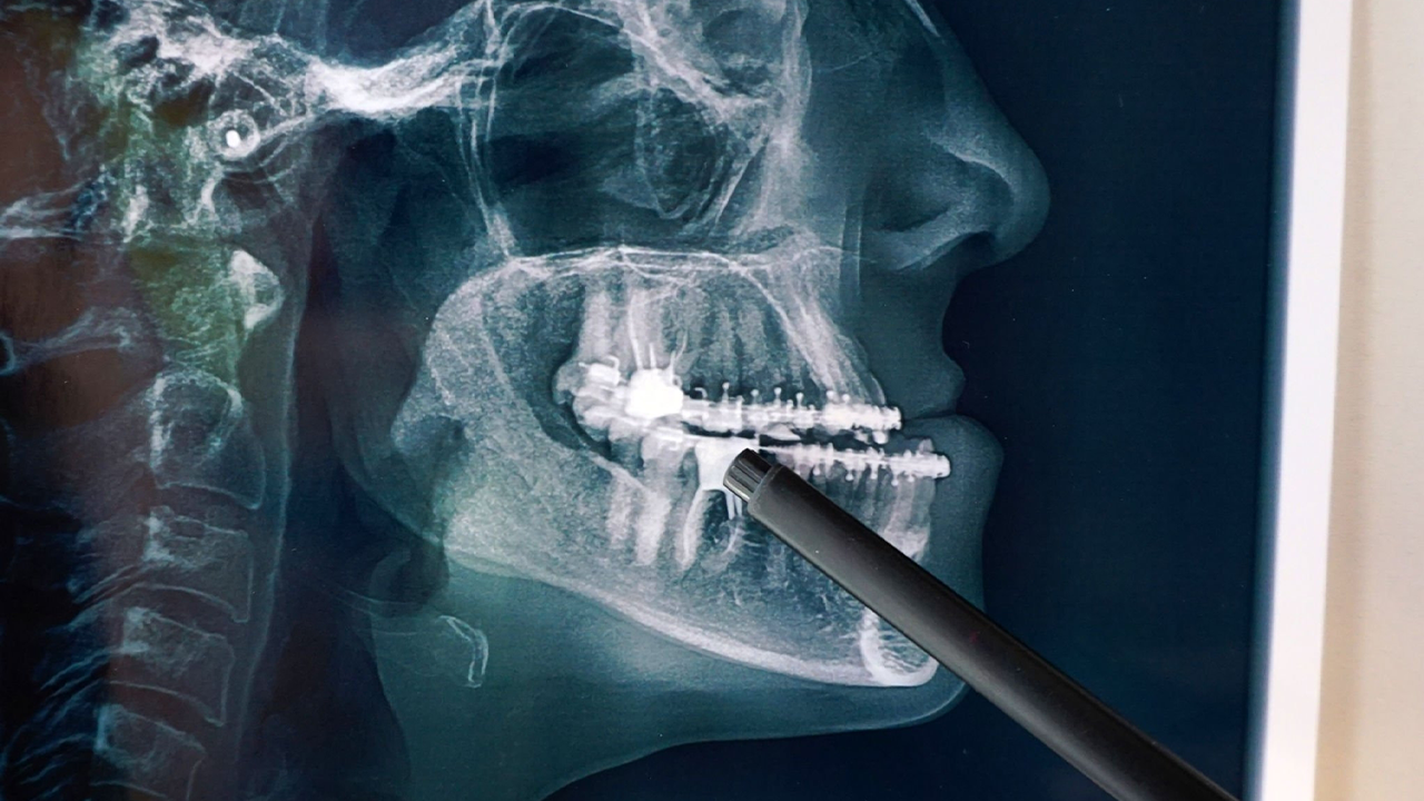 What Is A Maxillofacial Surgeon? - Oakwood Dental