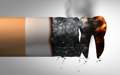 What Does Smoking Do to Your Oral Health?