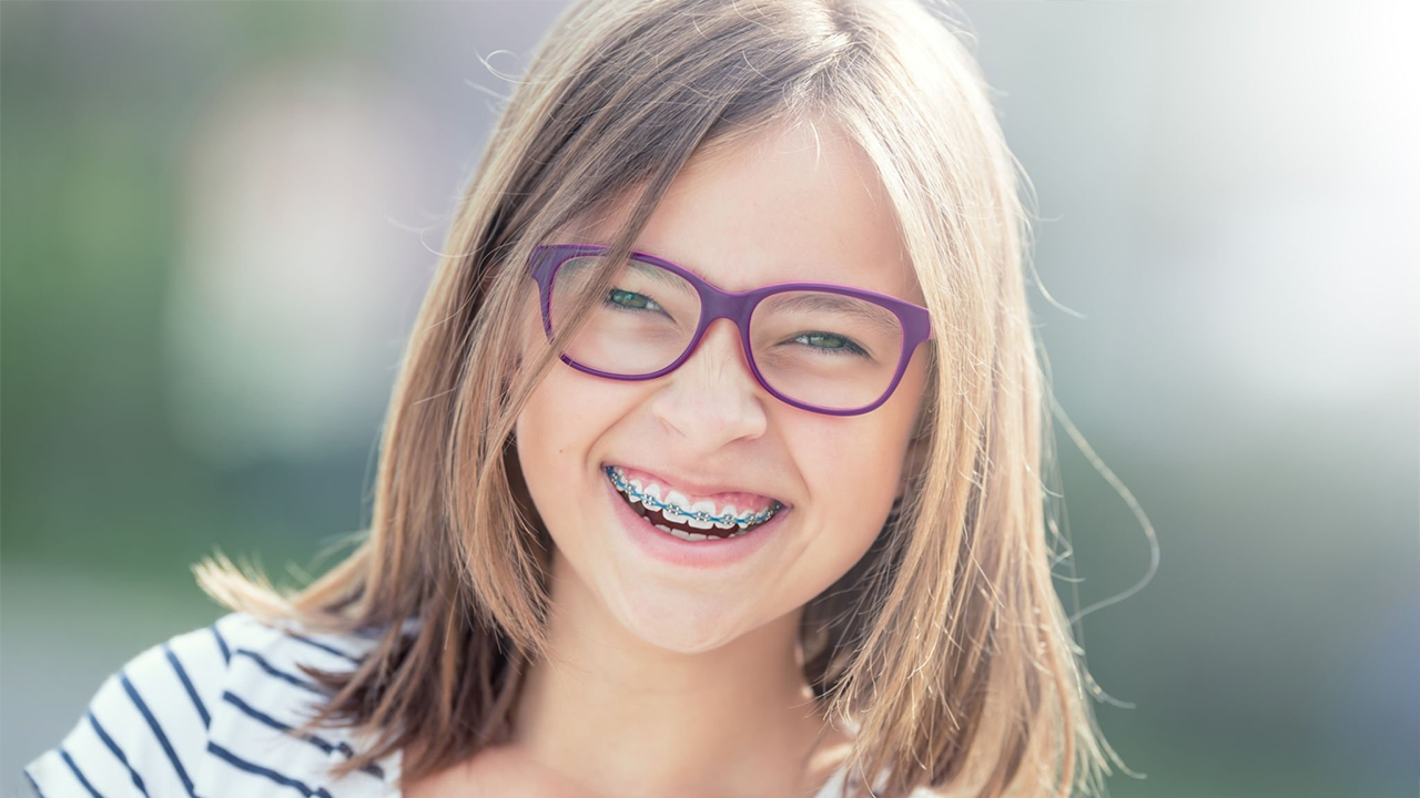 4 Important Things To Know Before Getting Braces - Oakwood Dental