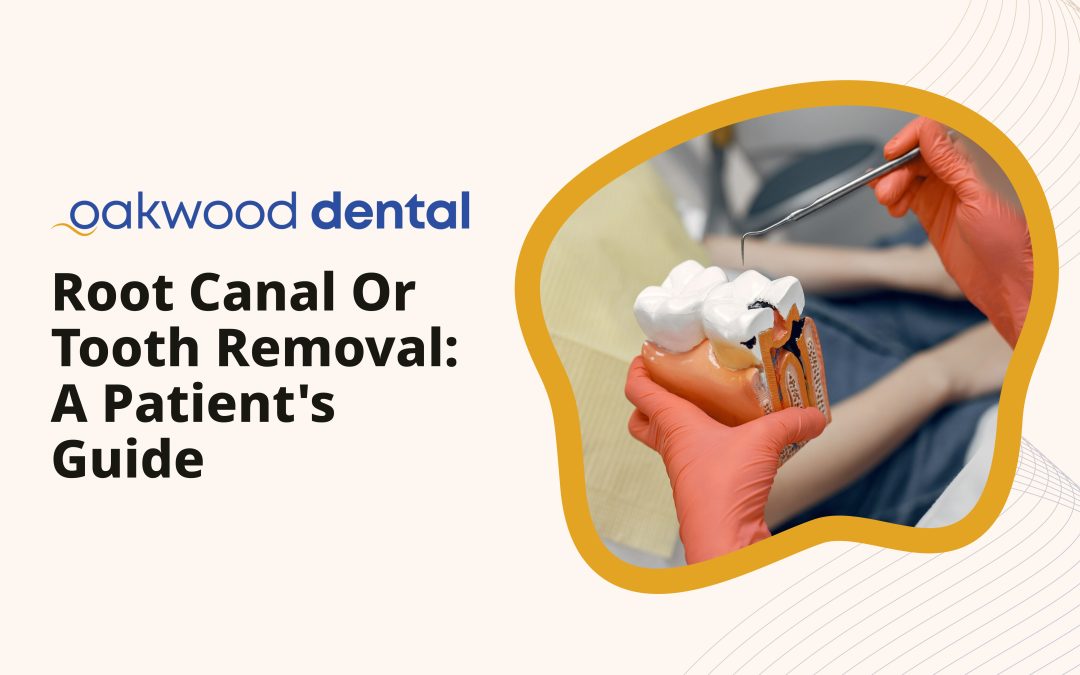 Root Canal or Tooth Removal: A Patient’s Guide