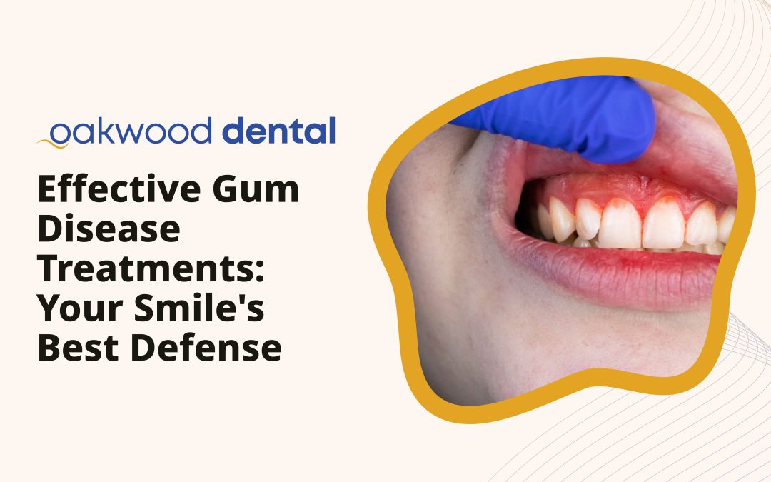 Effective Gum Disease Treatments: Your Smile’s Best Defense