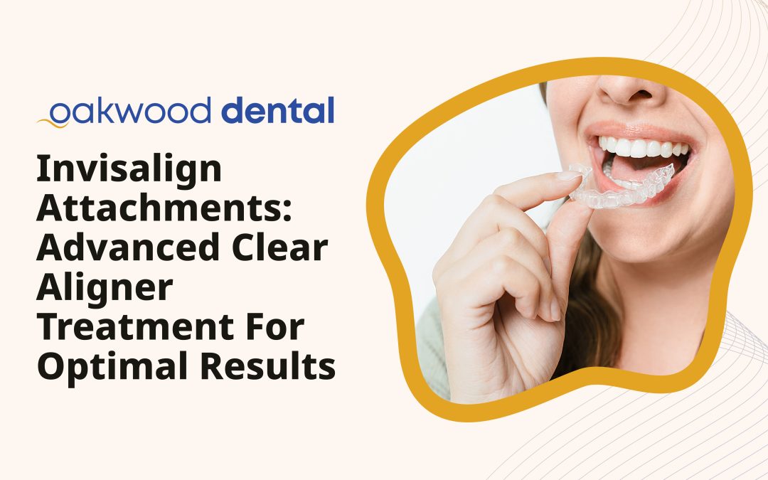 Invisalign Attachments: Advanced Clear Aligner Treatment for Optimal Results