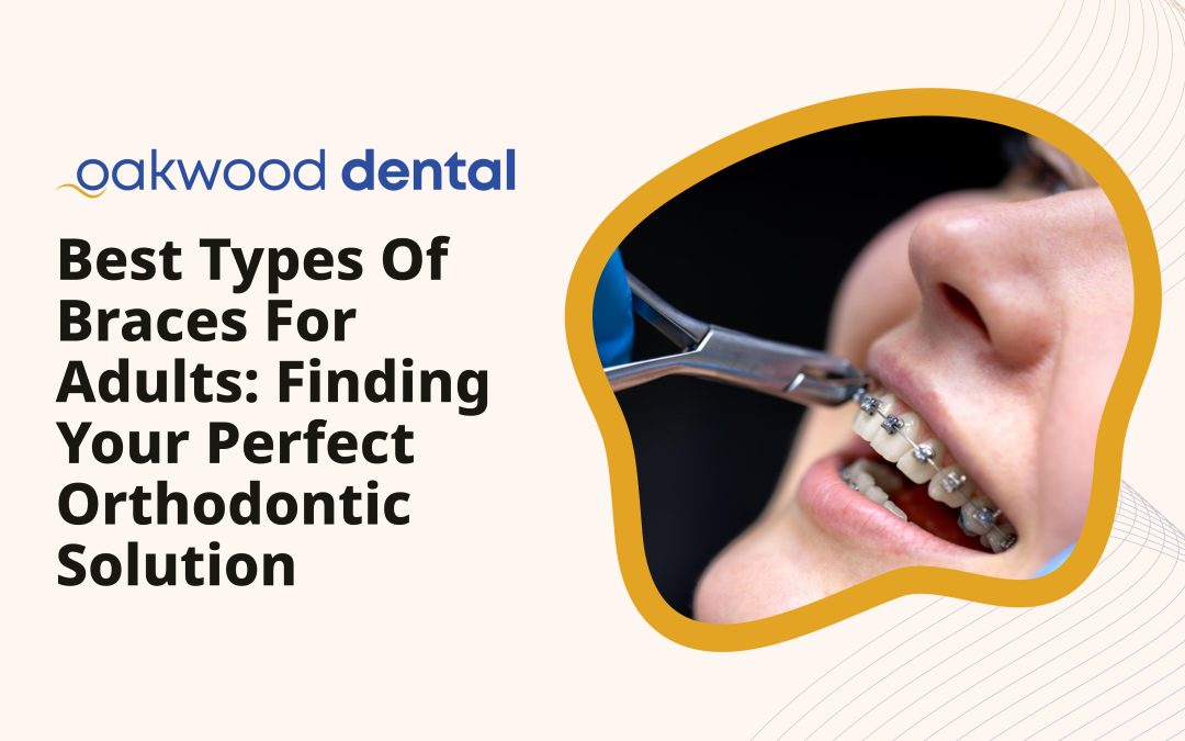 Best Types of Braces for Adults: Finding Your Perfect Orthodontic Solution