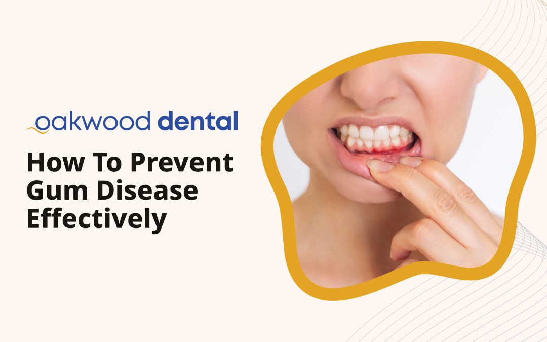 How to Prevent Gum Disease Effectively