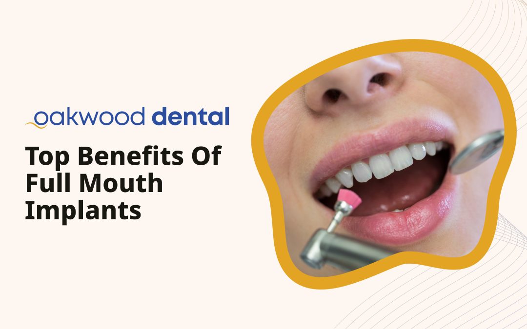 Top Benefits of Full Mouth Implants