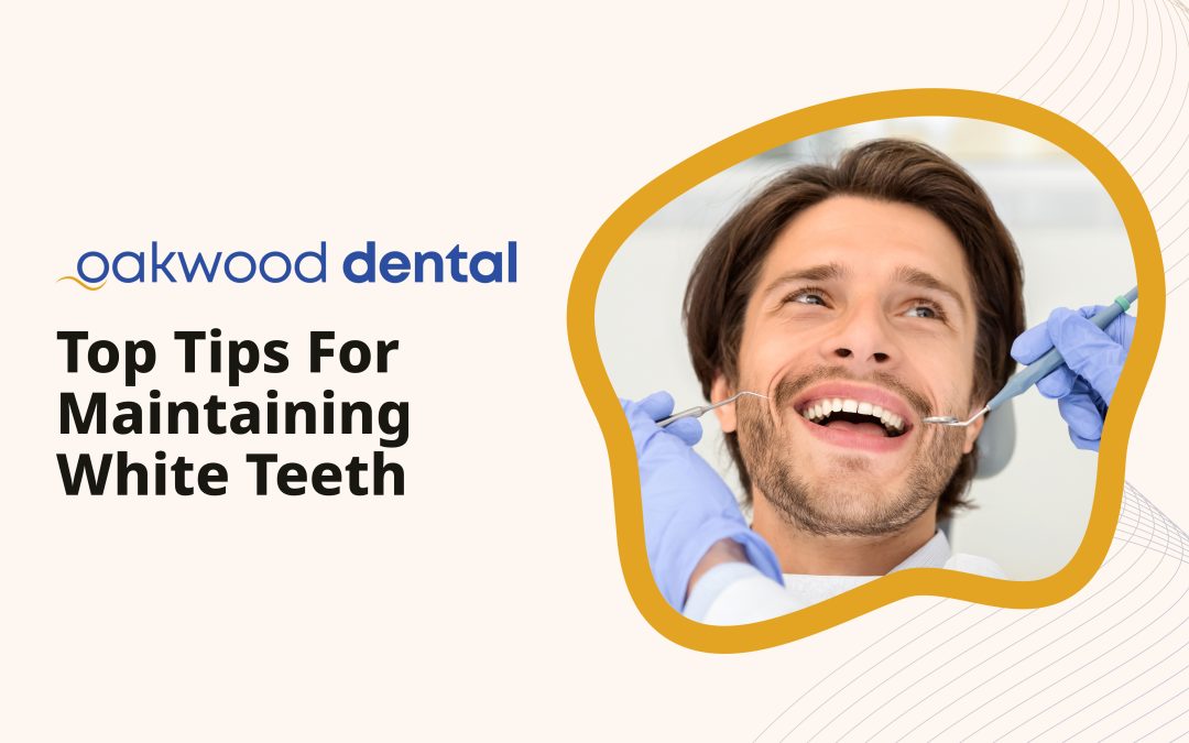 Top Tips for Maintaining White Teeth