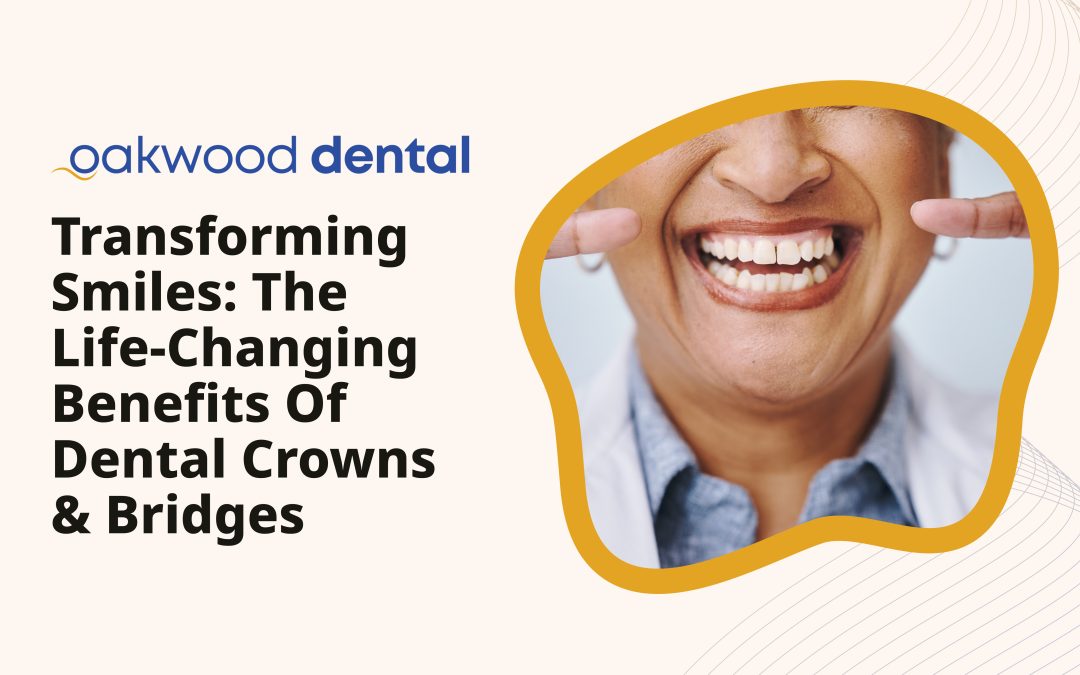 Transforming Smiles: The Life-Changing Benefits of Dental Crowns & Bridges