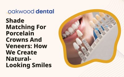 Shade Matching for Porcelain Crowns and Veneers: How We Create Natural-Looking Smiles